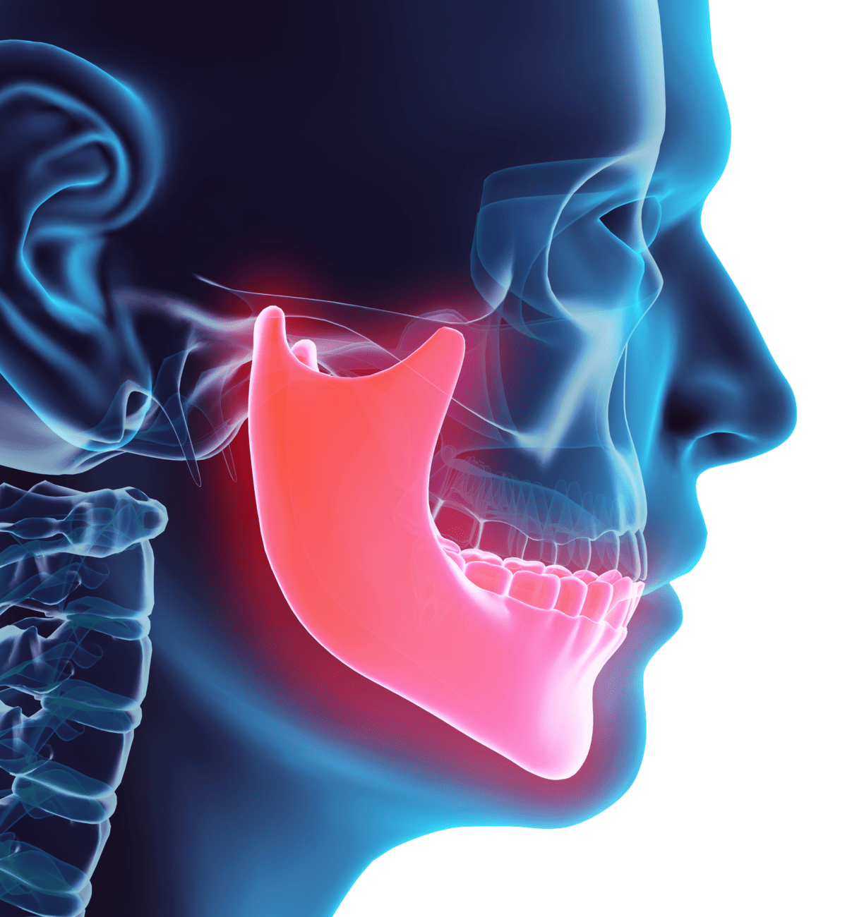 tmj-treatment-east-hanover-nj-jaw-pain-headaches